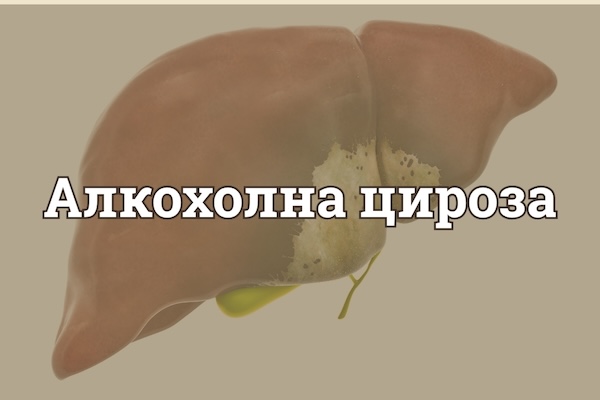 Алкохолна Цироза: Симптоми, Лечение и Рискове за Живота